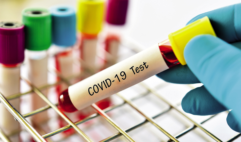 Blood sample to be tested for covid-19